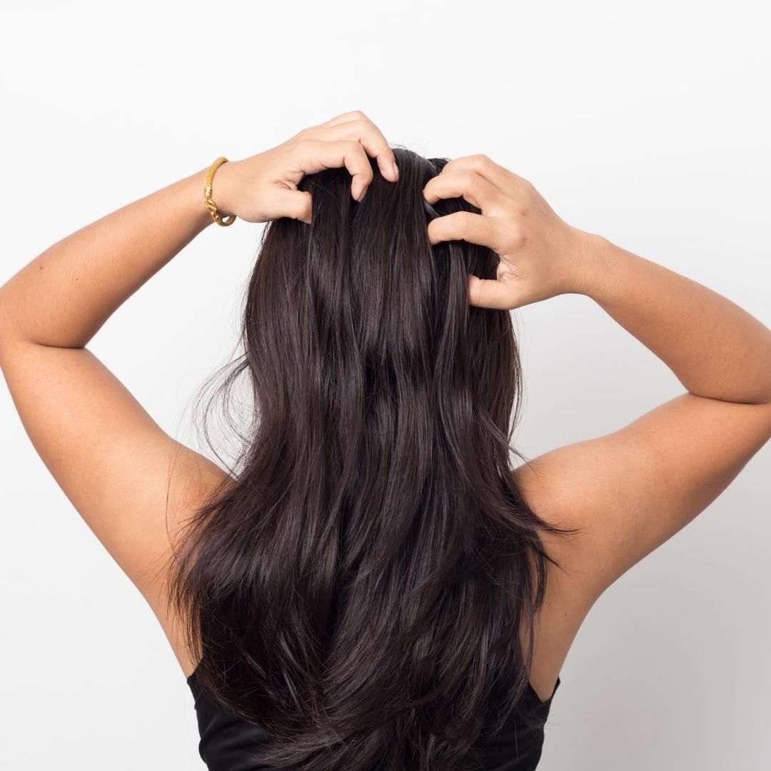 12 causas más comunes de pérdida de cabello en mujeres