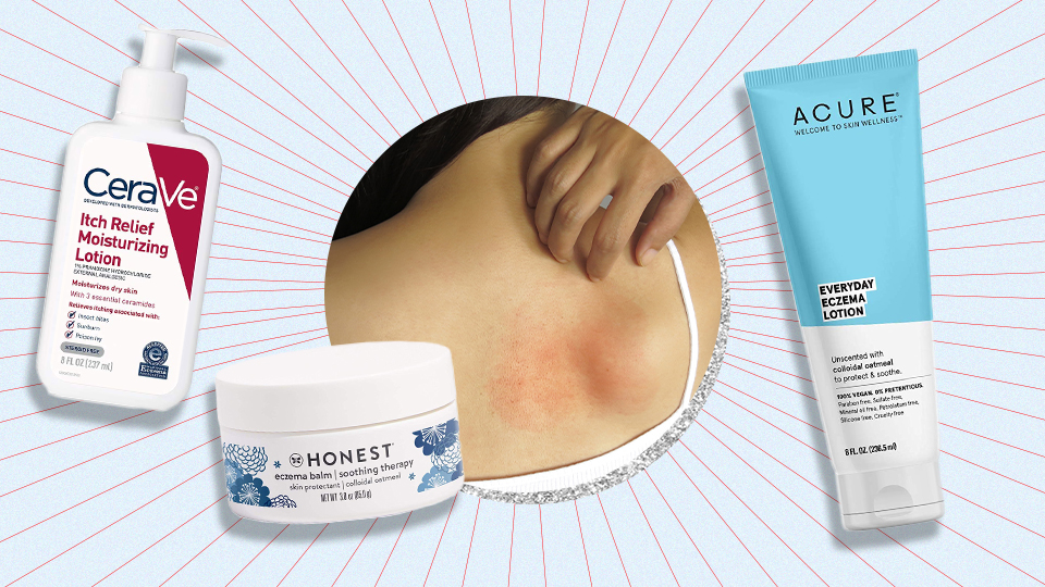 The Absolute Best Over-the-Counter Body Lotions for Eczema-Prone Skin
